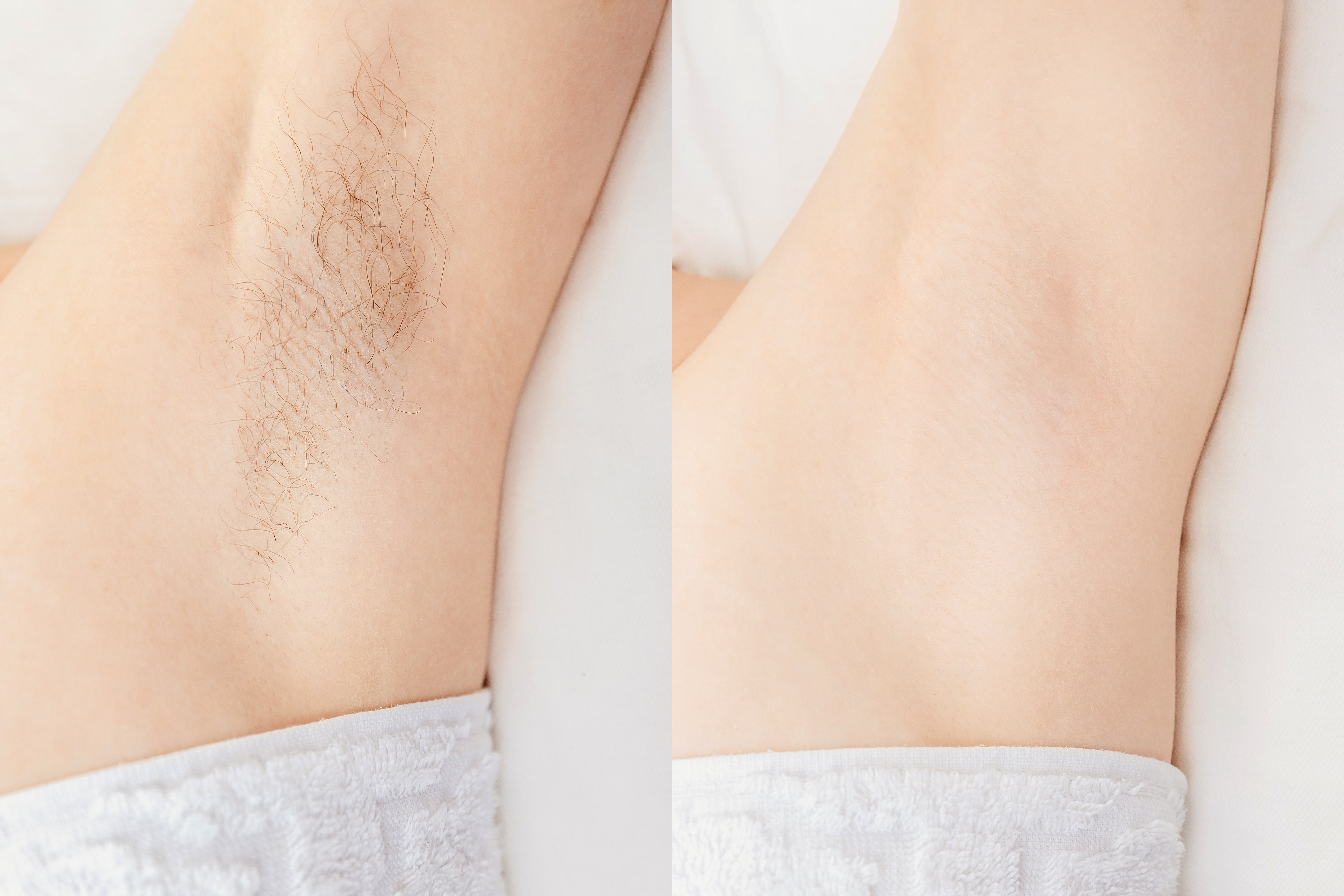 Instant-Results-Laser-Hair-Removal-at-DrBK-Clinic-in-Reading